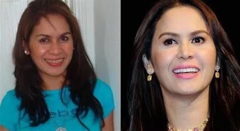 jinkee pacquiao before and after.